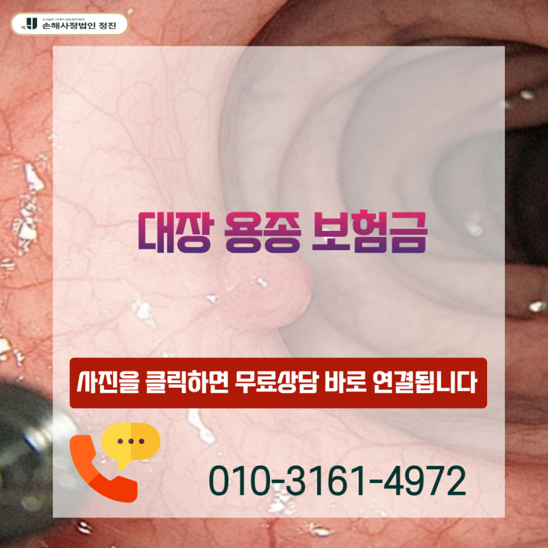 대장 용종 보험금, D12.6 결장 양성 신생물 제거 후 거절받으셨나요?