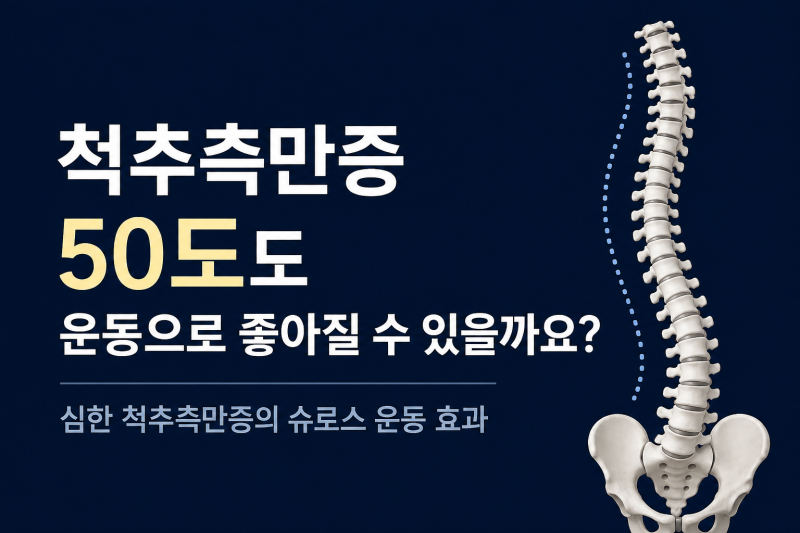 척추측만증 50도도 운동으로 좋아질 수 있을까요?｜심한 척추측만증의 슈로스운동 효과
