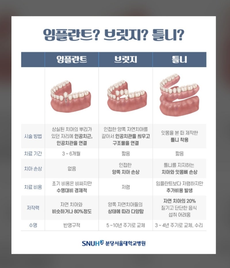 대구 임플란트 가격 차이, 저렴한 곳과 비싼 곳의 결정적 차이 4가지