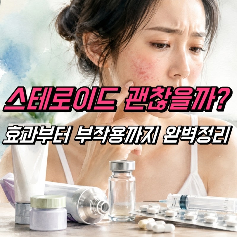 스테로이드 연고 주사 약, 효과 부작용 조심해야
