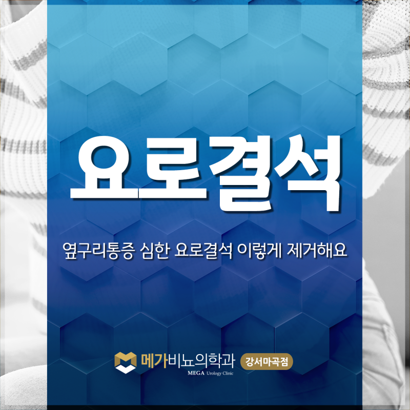 옆구리통증 심한 요로결석 이렇게 제거해요