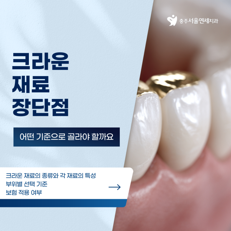 칠금동치과 크라운 재료마다 다른 장단점, 어떤 기준으로 골라야 할까요