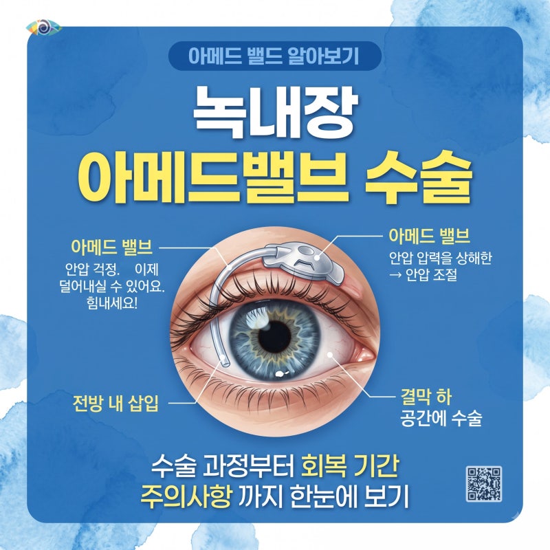녹내장 아메드밸브 수술 과정부터 회복 기간 주의사항 총정리