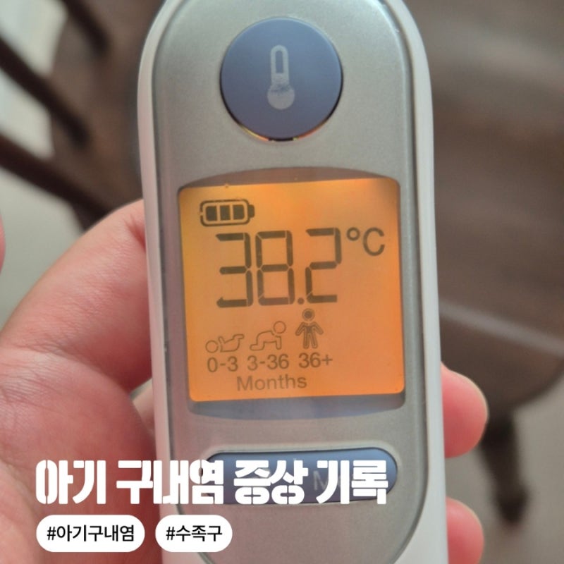 아기 구내염 증상과 고열, 1일차부터 3일차 생생 기록 (원인 바이러스 & 어른 구내염 차이점)