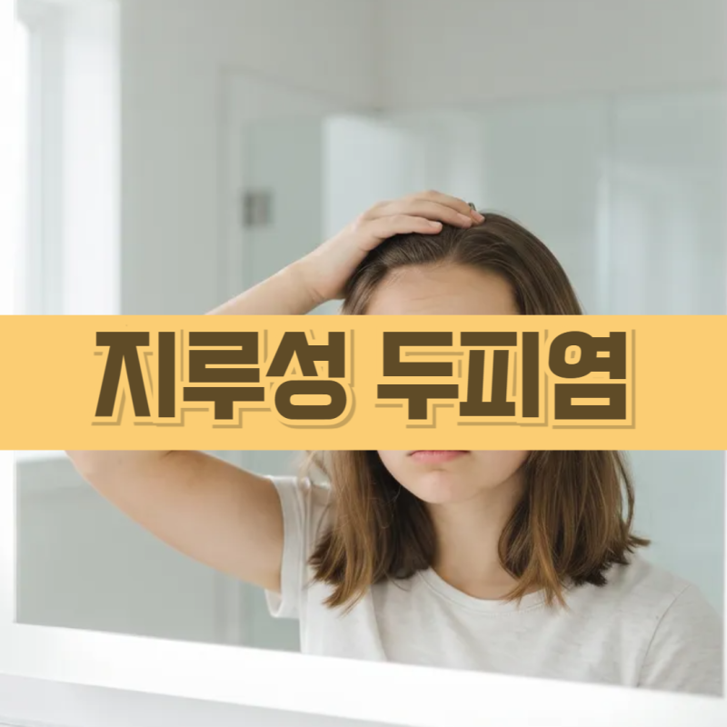 두피질환 지루성 두피염 원인 치료법 탈모 예방법