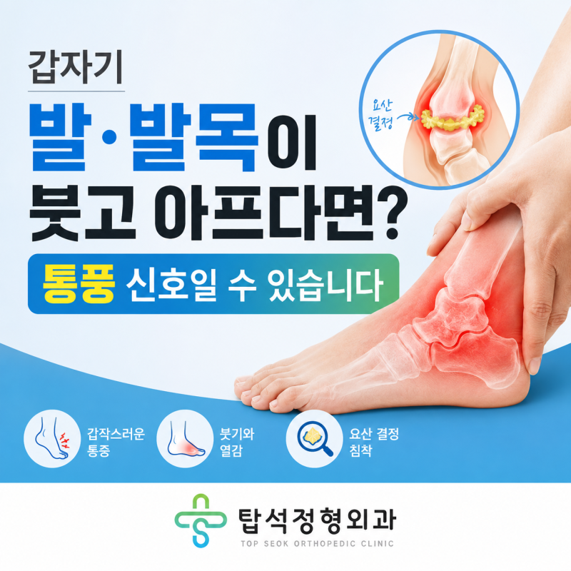 갑자기 발·발목이 붓고 아프다면? 통풍 신호일 수 있습니다