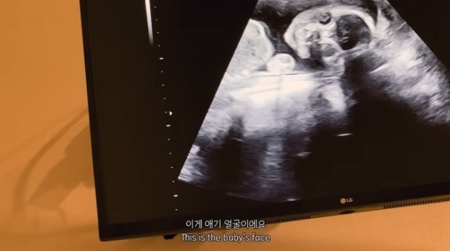 <b>박주호</b><b>안나 넷째 임신</b> 발표 - 새로운 가족 맞이 예고