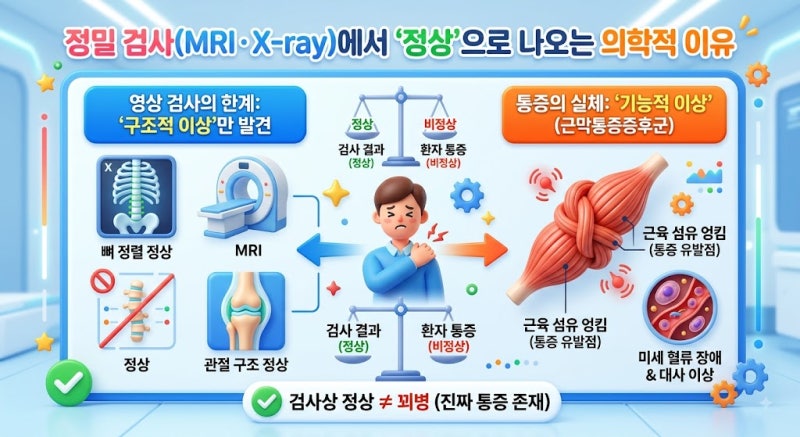 검사상 정상인 목·어깨 통증, 근막통증 증후군(MPS) 원인과 자가 진단·치료법 총정리