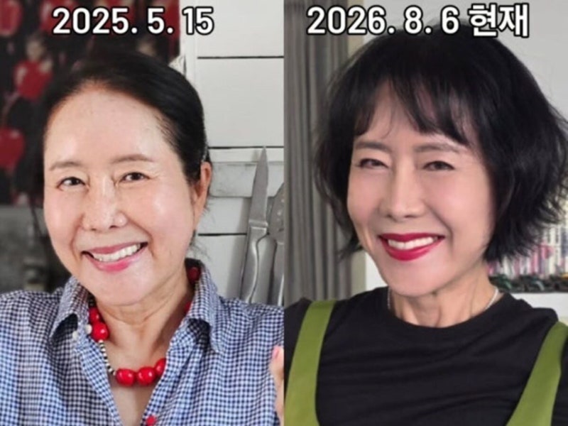 1년 만에 20년 젊어진 윤영미! 거상술·모발이식·다이어트 3연타 성공 비결