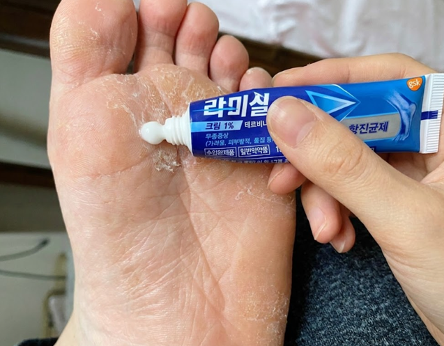 약국 라미실 스프레이 무좀 연고 써도 안 낫던 진짜 이유