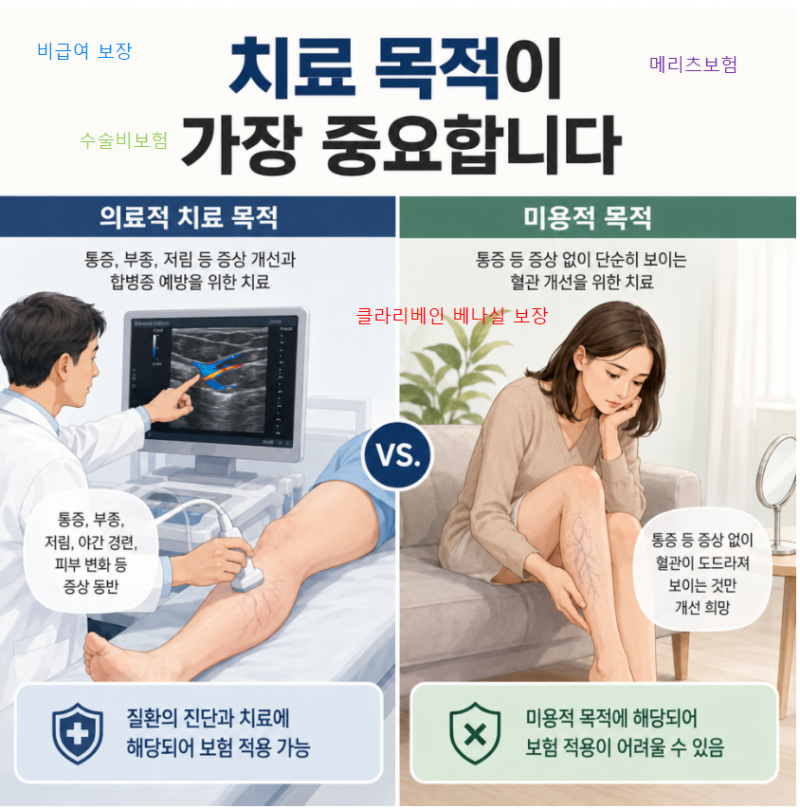 메리츠화재 하지정맥류 수술, 베나실과 클라리베인 비급여 보장 총정리