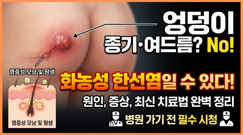 엉덩이 종기나 여드름인 줄 알았던 화농성 한선염, 원인부터 치료까지