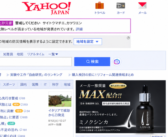 일본 홈쇼핑 탈모앰플 미녹신카 유명세만큼 대단할까? (객관적 후기)
