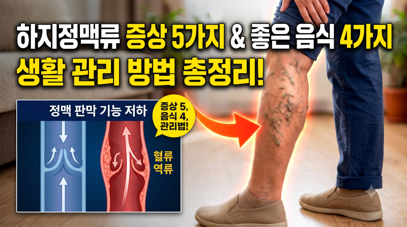 하지정맥류 증상 5가지와 좋은 음식 4가지, 생활 관리 방법