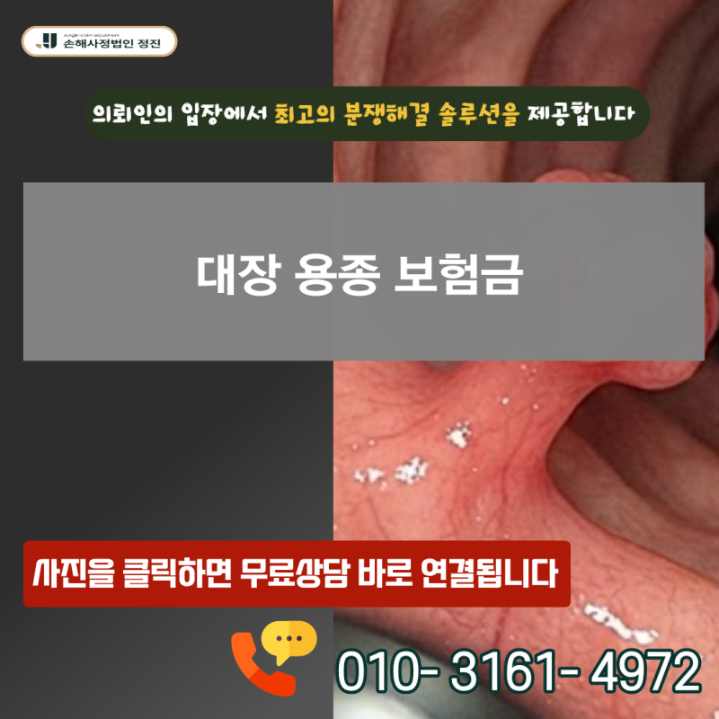 대장 용종 보험금, D12.6 진단받았는데 과연 전액 지급 가능할까?