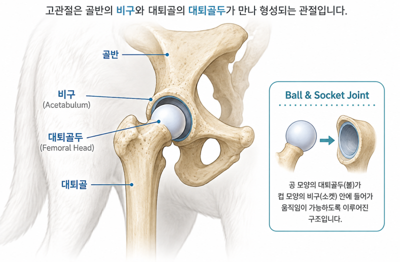 [정보] 고관절 전치환술 (THR) 알아보기