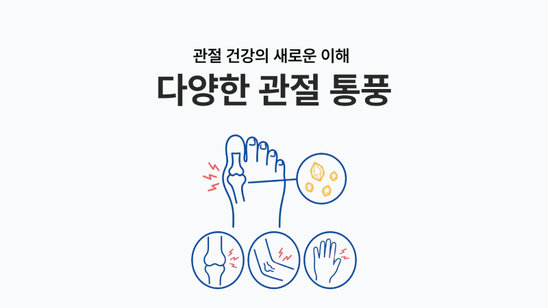 오산 통풍병원, 엄지발가락만 아픈 게 아닙니다!