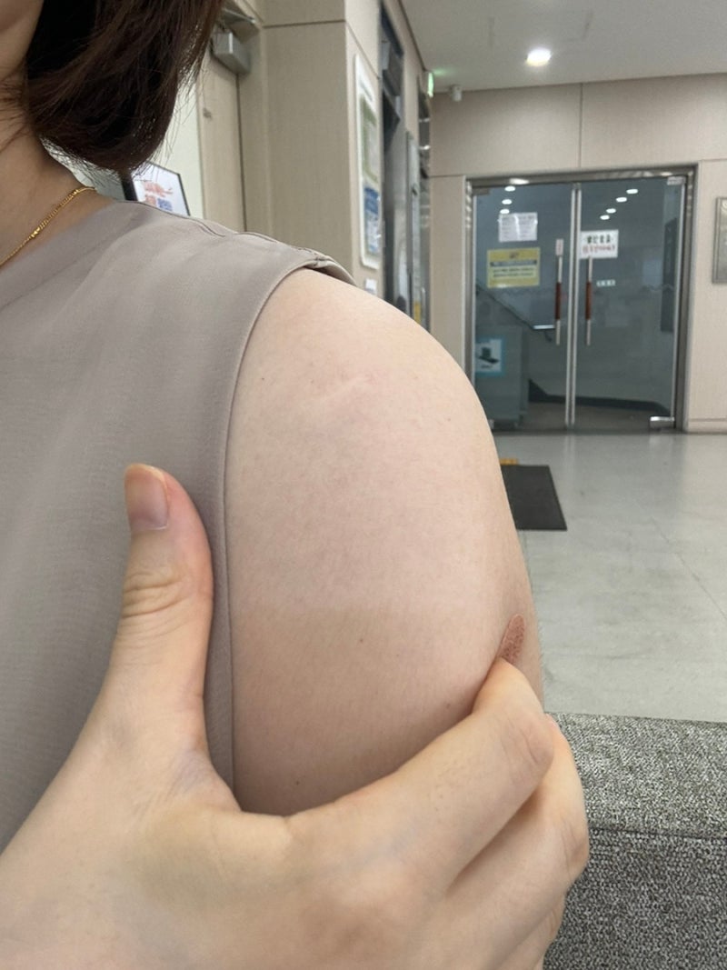송파보건소 B형간염 예방접종 임산부