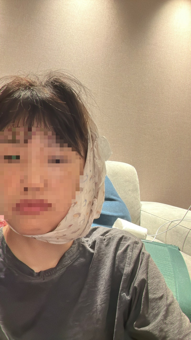 사랑니 발치 후 지혈 안 될 때 - 발치 당일 체크리스트