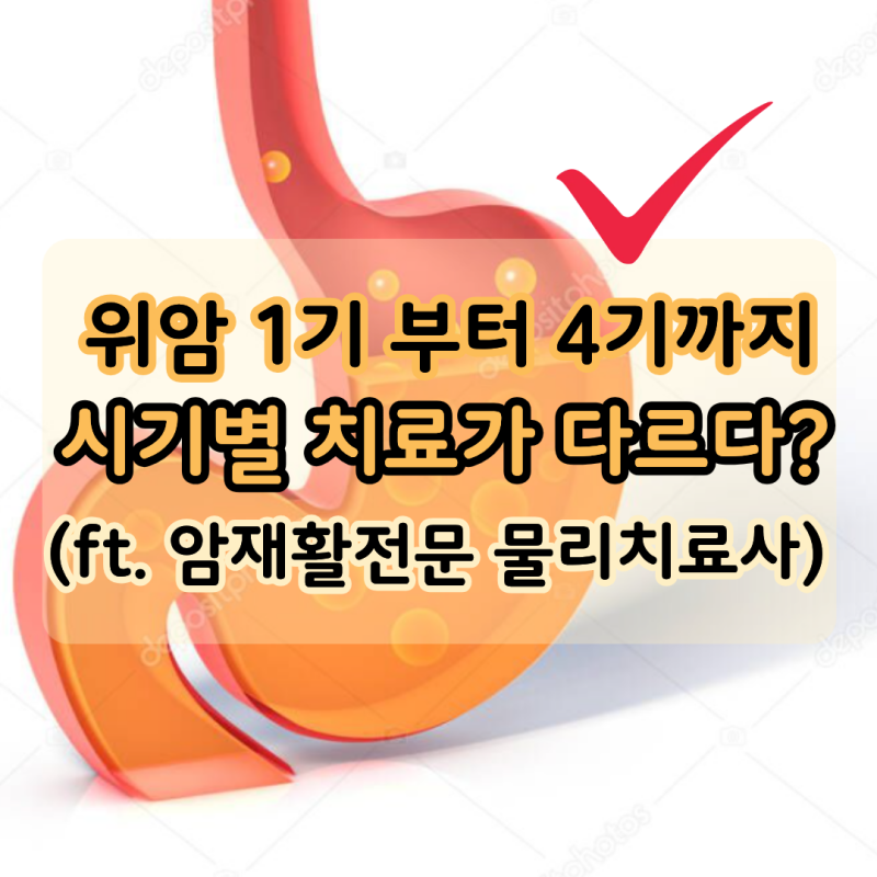 "위암 시기별 치료?" 위암 1기 2기 3기 4기 (ft. 암재활전문 물리치료사)