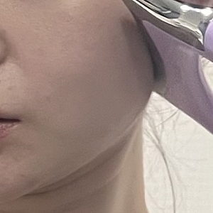 발란스핏 EMS괄사 내돈내산, 얼굴 붓기에 미친자의 홍현희EMS 1주 후기