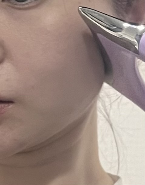 발란스핏 EMS괄사 내돈내산, 얼굴 붓기에 미친자의 홍현희EMS 1주 후기