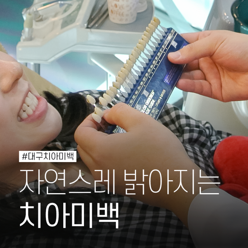 동성로 치과 이 시림 걱정 줄인 안전한 대구 치아미백