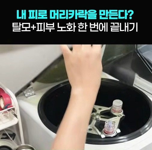 부산탈모병원추천 20대 탈모 원인부터 치료까지 총정리