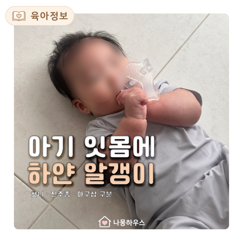 아기 잇몸에 하얀 알갱이가 보여요, 첫니·구강 진주종 구분법