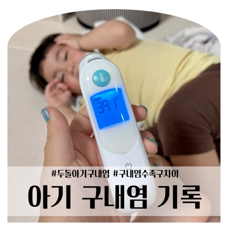 아기 구내염 수족구 차이 : 여행 당일 39도 고열, 감기인 줄 알았던 엄마의 기록