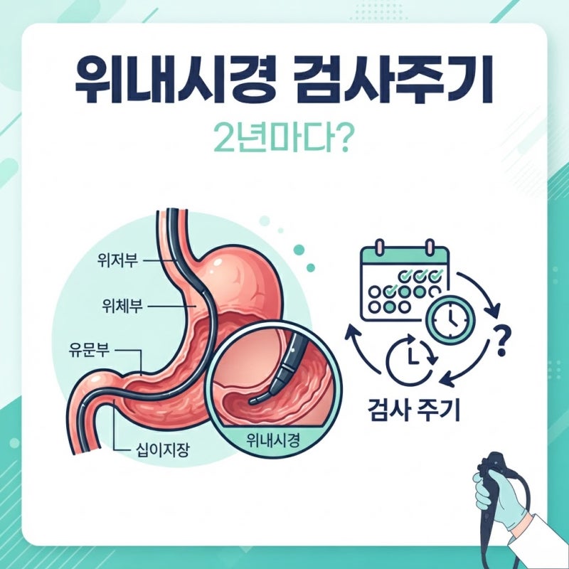 위내시경 검사주기 2년이면 될까? 40세 이후와 고위험군 기준