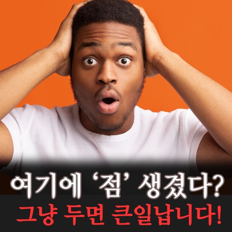 [발바닥 점 흑색종] 샤워 후 발견한 까만 점, 암일까?