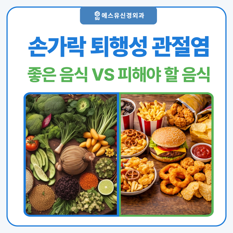 손가락 퇴행성관절염에 좋은 음식과 피해야 할 음식 어떤 게 있을까요?