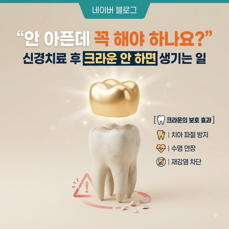 서울두정치과) "안 아픈데 꼭 해야 하나요?" 신경치료 후 크라운 안 하면 생기는 일