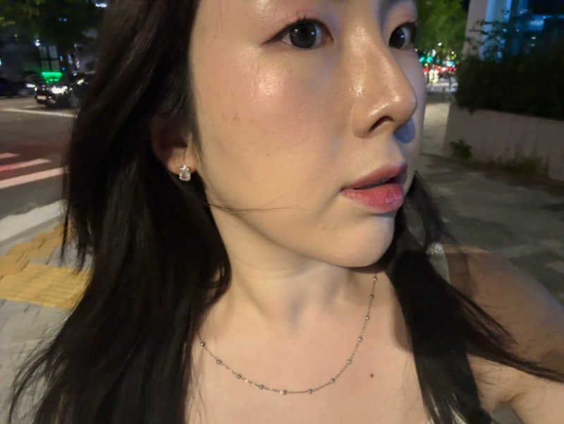 청담 고우리 PCL 솔직후기 | 청담 피부과 고우리스킨부스터 가격, 효과, 통증까지