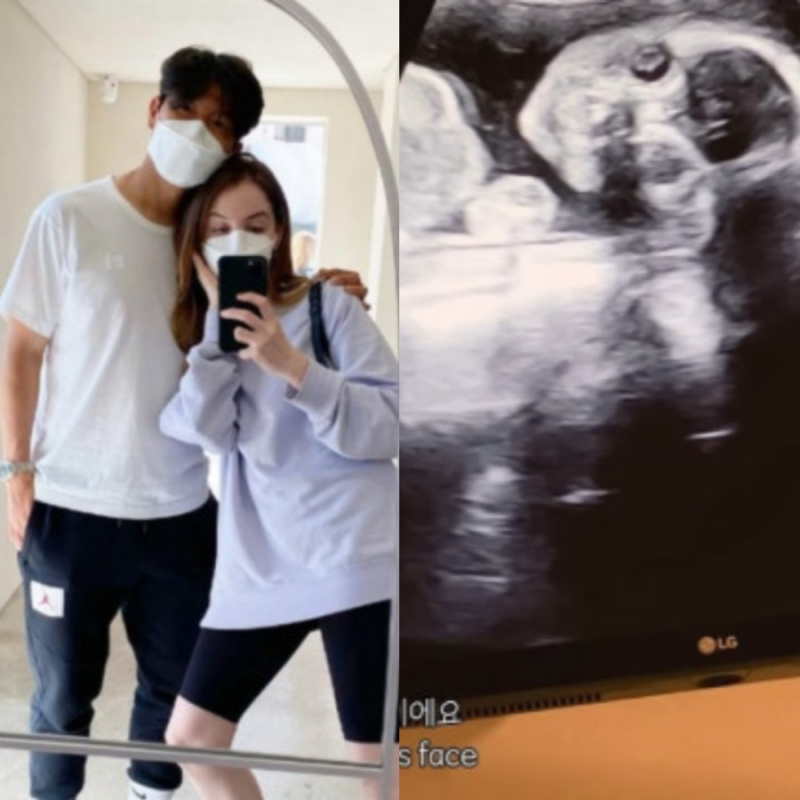 궁금했는데 정말 기쁜 소식… 박주호·안나 부부, 암투병 이겨내고 넷째 임신