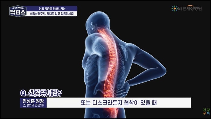 씨암주사 생리부터 음주까지 자주 묻는 질문 정리