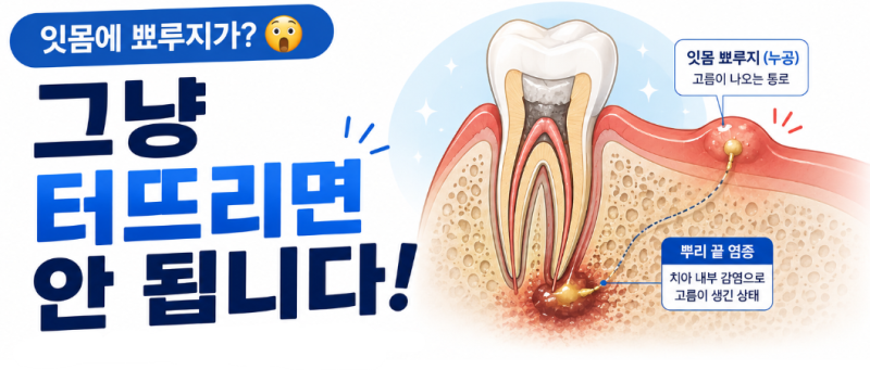 잇몸에 뾰루지가 생겼어요! 그냥 터뜨려도 될까요?