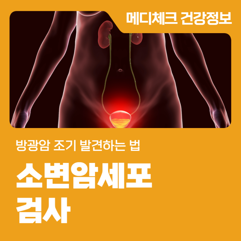 인천건강검진협회 소변암세포검사 방광암 조기 발견하는 법