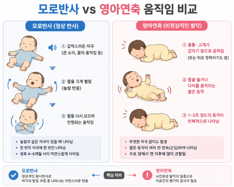 아기가 갑자기 몸을 움찔한다면? 영아연축 증상과 모로반사 차이