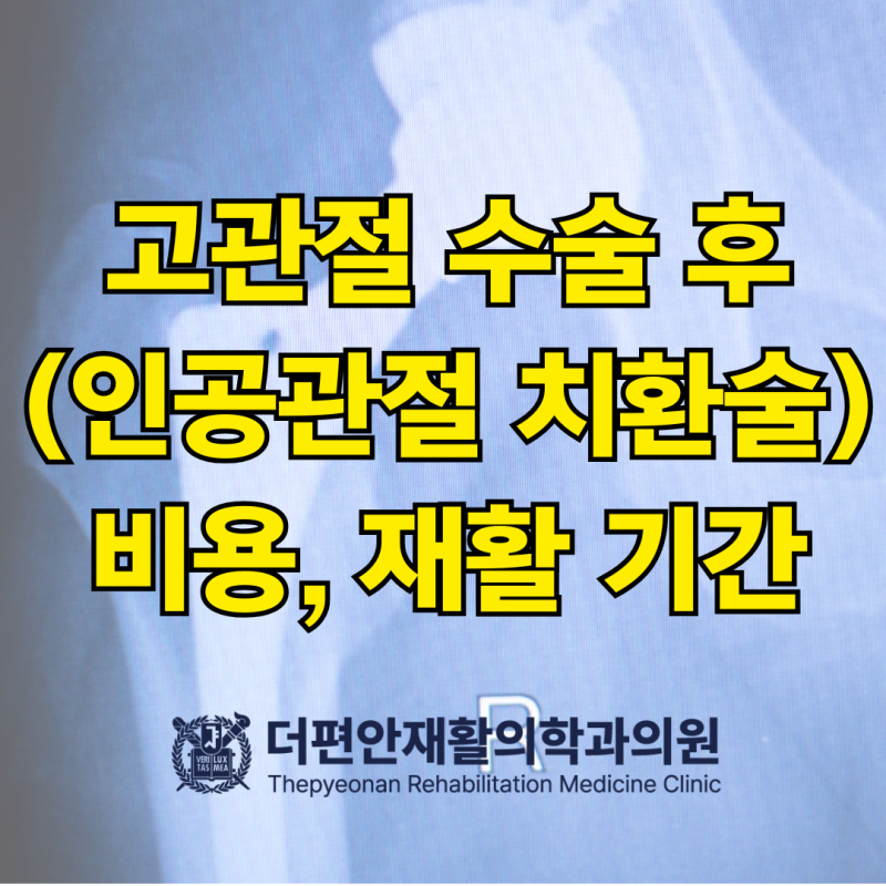 고관절 인공관절 수술비 얼마나? 재활병원은?