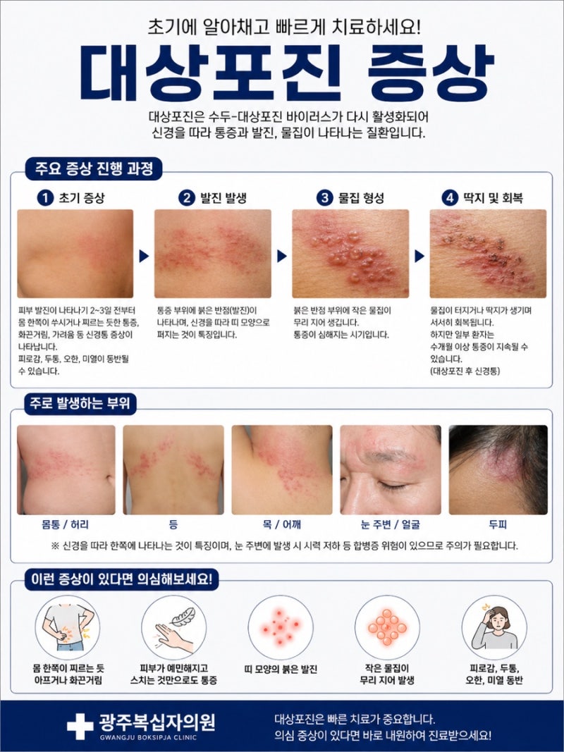 대상포진 예방접종 꼭 맞아야할까요? 광주복십자의원에서 스카이조스터 vs 싱그릭스 차이부....