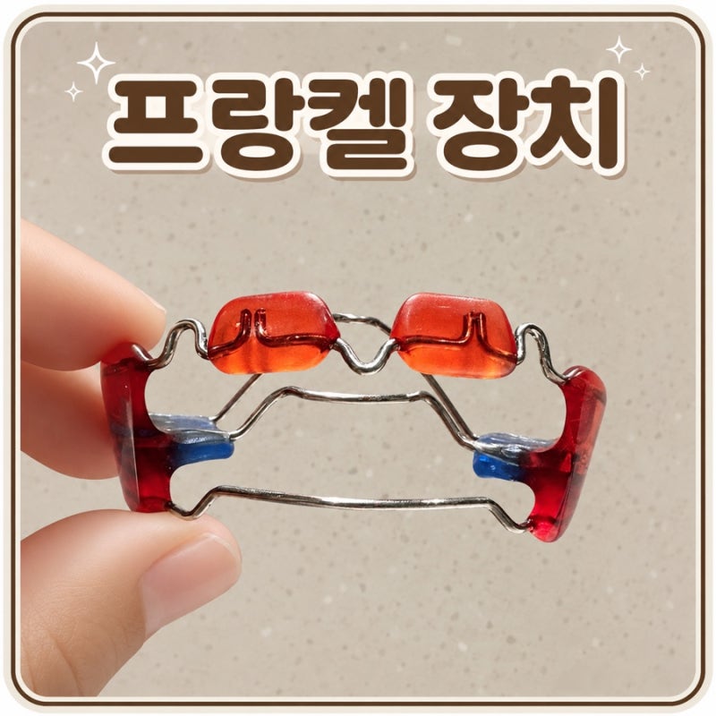 프랑켈 장치 2개월 사용 후기｜5세 아이 반대교합 변화 과정