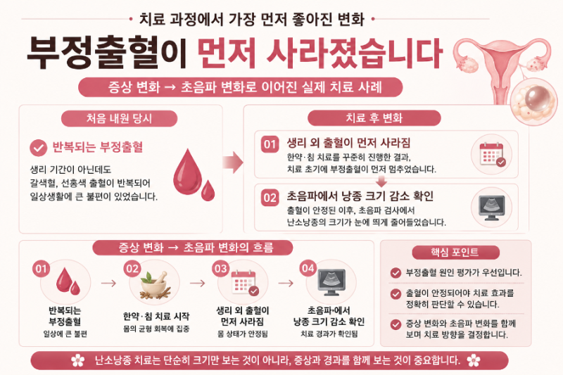 3.64cm 난소낭종, 두 달 만에 84% 줄어든 이야기/압구정한의원