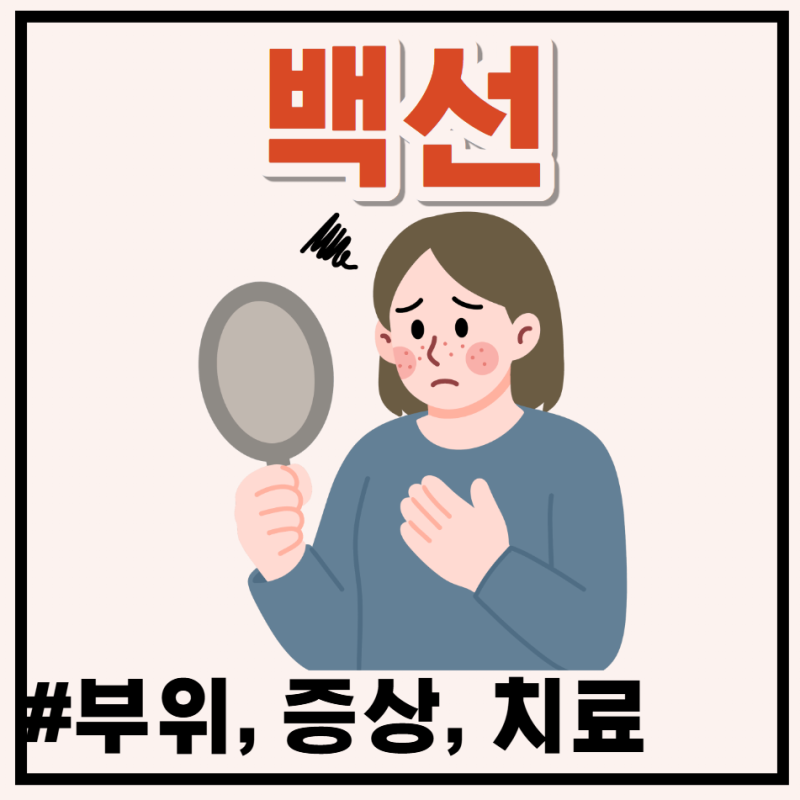 붉은 반점 심한 가려움 등 피부백선 부위별 증상과 완치 치료 관리법