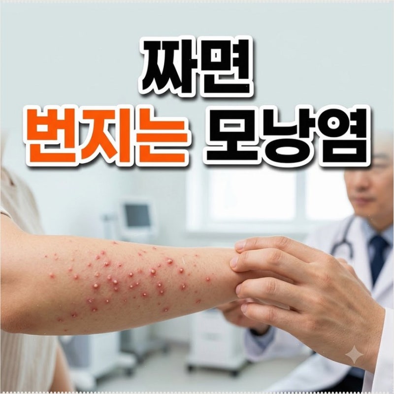 여름철 모낭염 증상 원인 여드름 구별법 억지로 손대면 진피층 흉터 남기 쉽습니다