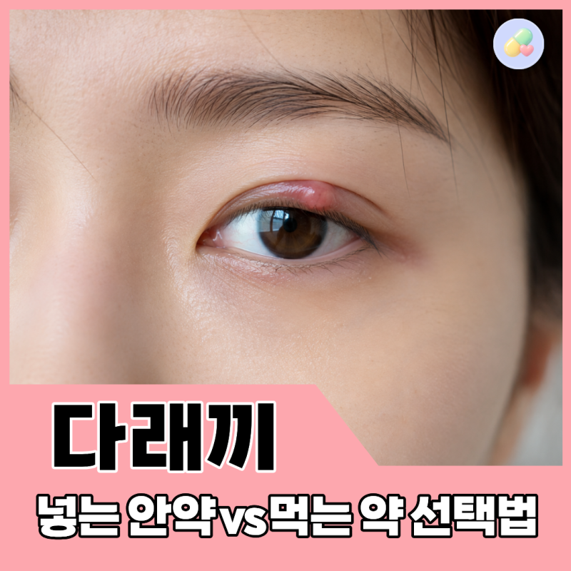 다래끼 났을 때 약국 약! 넣는 안약 vs 먹는 배농산급탕 비교 정리