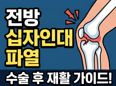 전방 십자인대 파열 증상 및 수술 후 재활 운동 완벽 가이드