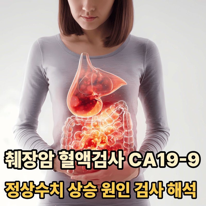 췌장암 혈액검사 CA19-9 정상수치·상승 원인·검사 해석