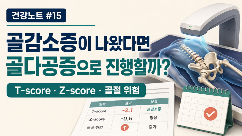 골밀도 검사에서 골감소증이 나왔다면, 골다공증으로 진행할까? T-score와 Z-score의 차이부터 ....